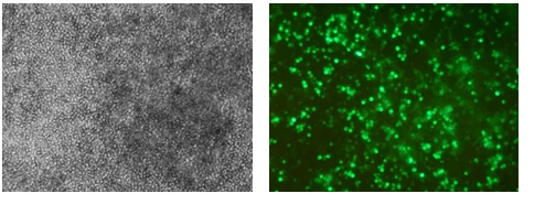Representative microscopy images showing GFP fluorescence and expression in human neutrophil cells at 18 hours after transfection using Celetrix electroporation.