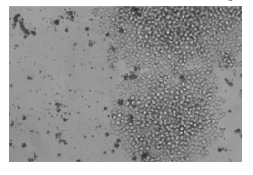 Microscope brightfield image demonstrating successful hybridoma fusion of mouse spleen cells and myeloma cells with high cell viability using Celetrix systems.