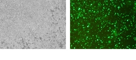 Bright-field and fluorescent microscope images of mouse primary spleen cells after electroporation using Celetrix system in PBMC mode at 1350V, showing high transfection efficiency.